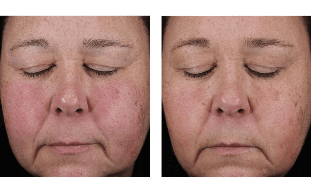 A woman with visible skin quality improvements after using Mystro Active Balance Serum