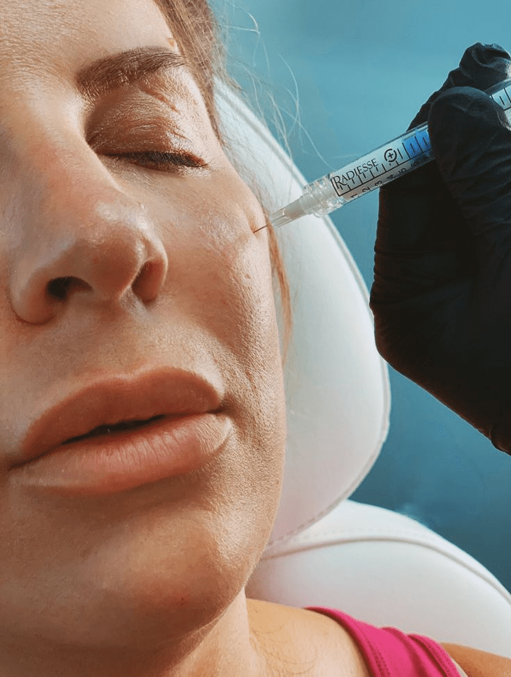 Radiesse Scottsdale Injections