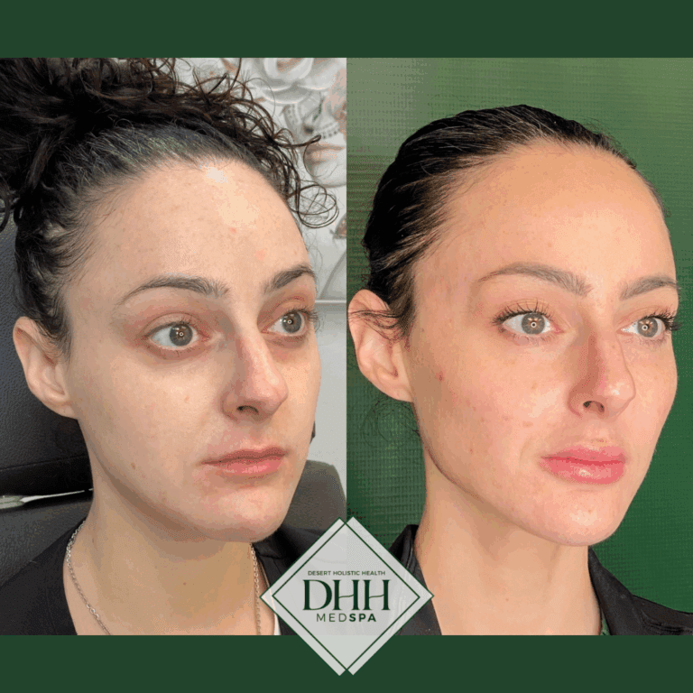 Facial Balancing in Scottsdale: Achieve a Naturally Proportioned Look