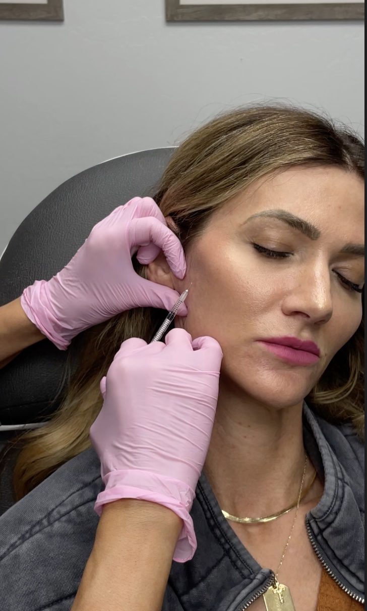 Botox injection to lift cheeks