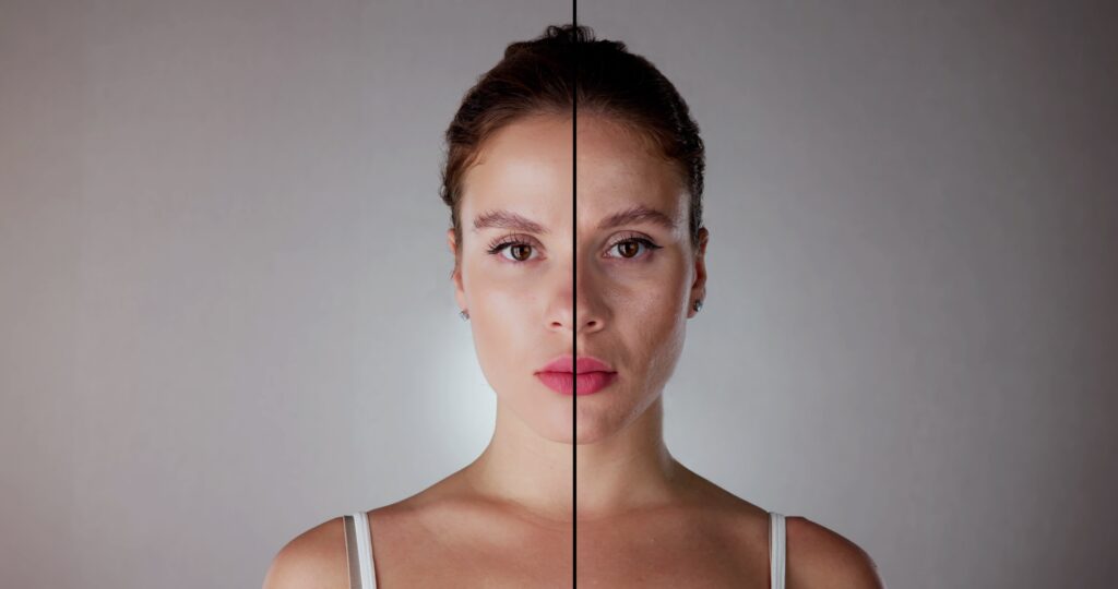 before and after treatments of non-surgical facelifts in scottsdale arizona