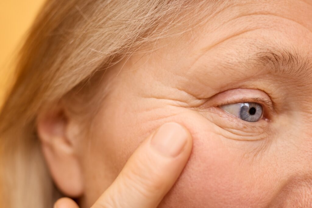 Letybo injection for crow's feet treatment at DHH Med Spa Scottsdale